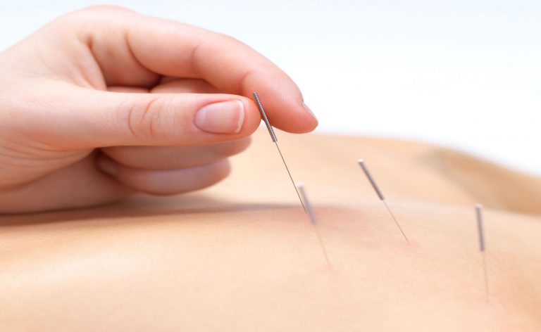 The Science of Acupuncture – Body regaining the lost energy through needles treatment
